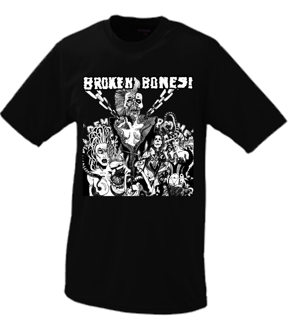 Broken Bones “Dem Bones”